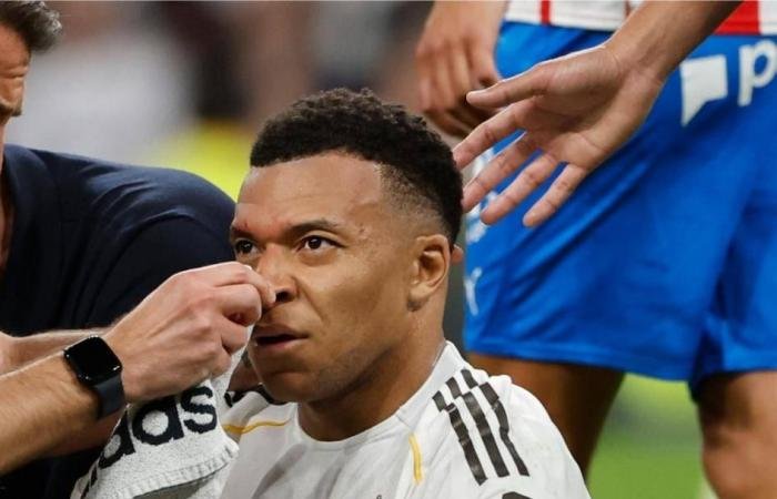 الرياضة الان | لماذا اختفى «الدم» الذي فجّر وجه مبابي أمام الكاميرات؟ | عيون الجزيرة الرياضي